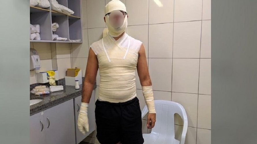 Foto: Reprodução