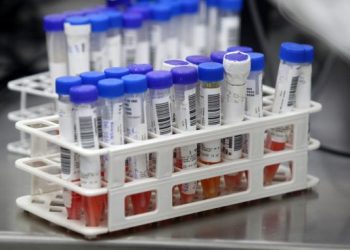 Candeias: Número de infectados a 306; taxa de isolamento atinge 37,3%