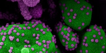 Registrada reinfecção da covid com variante do vírus em paciente na BA