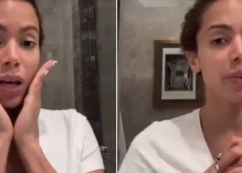 Anitta revela que usa creme feito do próprio sangue para cuidar da pele