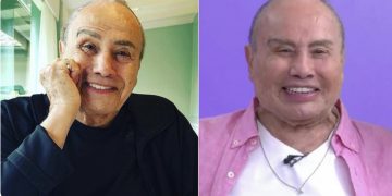Stênio Garcia fica irreconhecível após realizar harmonização facial