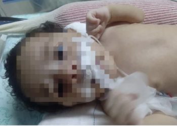 Recém-nascido morre após ter leite injetado na veia, em Salvador