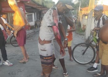 SFC: Homem fica gravemente ferido após tentar tirar combustível em carreta em movimento