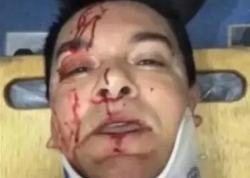 Regis Danese fraturou três costelas, tórax e punho; cantor está na UTI em estado grave