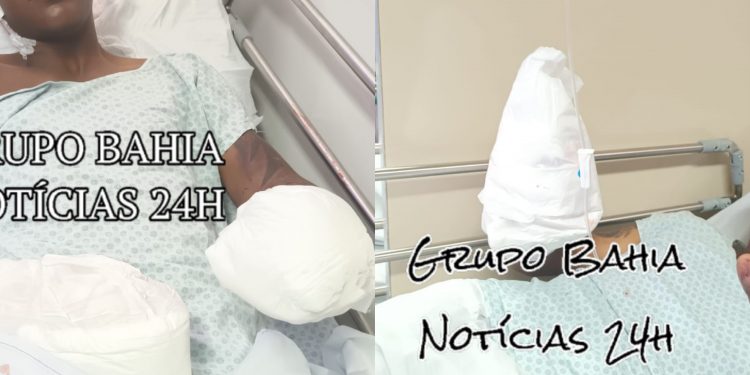 “DE OUTRO BAIRRO”: Jovens têm as mãos decepadas por traficantes de Cajazeiras