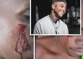 BOXE AFIADO: Kannário dá murro na cara de homem que teria olhado “maldosamente” sua filha