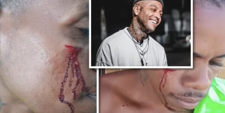 BOXE AFIADO: Kannário dá murro na cara de homem que teria olhado “maldosamente” sua filha