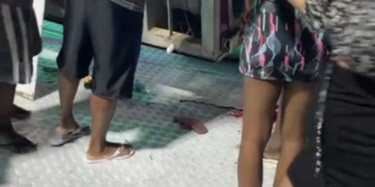 DESESPERO NO PARQUE: brinquedo desaba e homem perde o braço em Salvador 