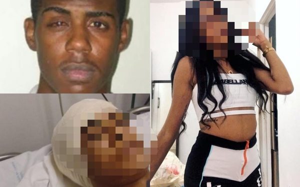 Traficante de vulgo “Arroz”, líder do Curuzu, raspa o cabelo da namorada e dá 3 tiros nela; vítima está no hospital