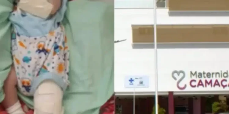 Bebê morre e outro tem a perna quebrada na Maternidade de Camaçari