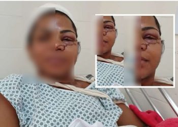 NA FRENTE DO FILHO: Mulher é atacada por ex-marido e esfaqueada com facão em São Francisco do Conde