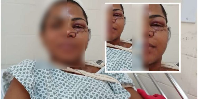 NA FRENTE DO FILHO: Mulher é atacada por ex-marido e esfaqueada com facão em São Francisco do Conde