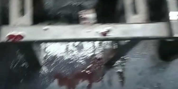 Candeias: Aluno do colégio estadual Luís Viana Filho é atacado por outro a faca ao retornar para casa