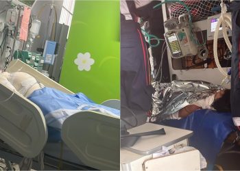 Sogra ateia fogo em adolescente de 15 anos enquanto vítima dormia em Salvador 