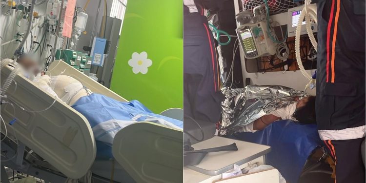 Sogra ateia fogo em adolescente de 15 anos enquanto vítima dormia em Salvador