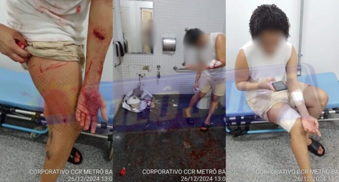 PIA QUEBRA: jovem se machuca durante relação sexual com outro rapaz no banheiro do metrô em Salvador