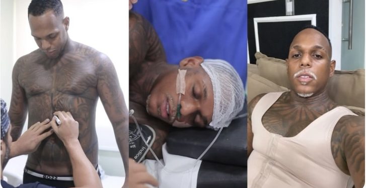 Oh Polêmico passa por lipoaspiração e se afasta dos palcos para recuperação: “Procedimento foi bem-sucedido”