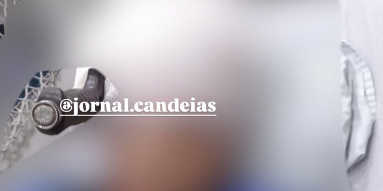 DEUS É MAIS: Jovem fica com faca cravada na cabeça após briga em Candeias