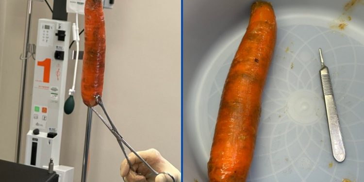 Homem é internado após dar entrada em hospital com cenoura de 20cm no ânus