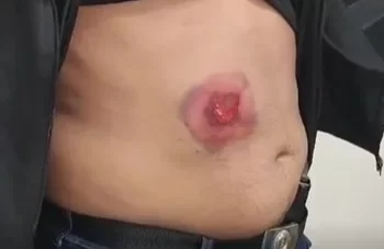 Policial Civil é baleado durante operação do Sul da Bahia