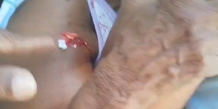 TRISTE: morre idosa de 87 anos baleada em tiroteio no Vale das Pedrinhas, no Complexo do Nordeste de Amaralina