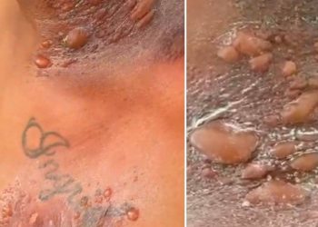 Soldado da PM sofre queimaduras graves durante treinamento na Bahia