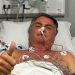 Jair Bolsonaro passa por cirurgia para tratar obstrução intestinal em hospital de Brasília