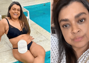 CÂNCER NO INSTESTINO: entenda a doença que tirou a vida de Preta Gil aos 50 anos e cresce entre os jovens