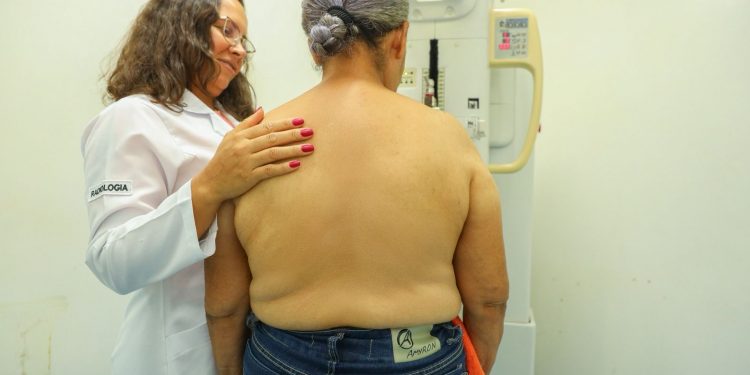 Candeias: Ação do Outubro Rosa oferece mais de 130 mamografias gratuitas por dia