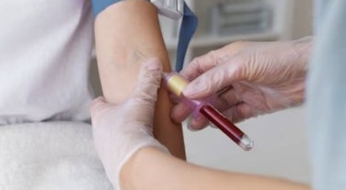 Pesquisa brasileira valida exame de sangue para diagnóstico precoce do Alzheimer; entenda
