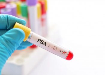 Novembro Azul em Candeias: Prefeitura divulga cronograma para exames de PSA nas Unidades de Saúde