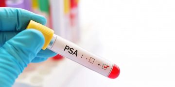 Novembro Azul em Candeias: Prefeitura divulga cronograma para exames de PSA nas Unidades de Saúde