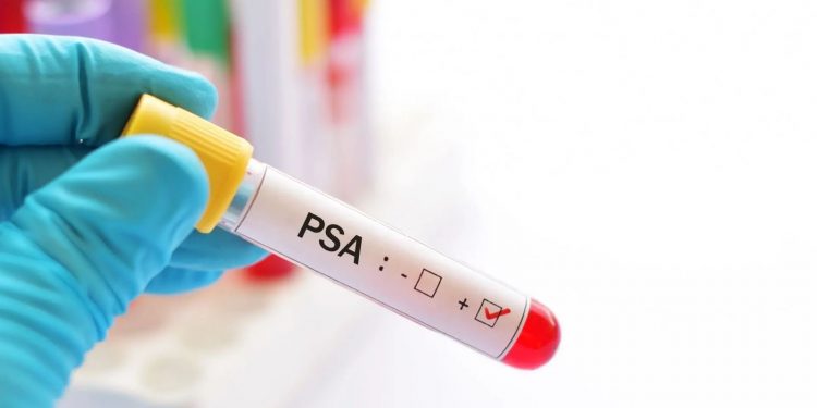 Novembro Azul em Candeias: Prefeitura divulga cronograma para exames de PSA nas Unidades de Saúde